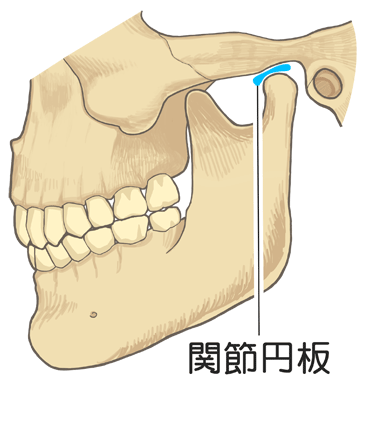 顎関節症について